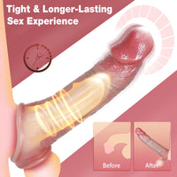 Amateur Penis Extender Vibrating Cock Sleeve with 10 Vibrations & Remote Control (<30 dB)